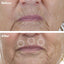 Advanced Anti-Aging Retinol + c-PDRN® Serum 30 mL / 1 fl oz
