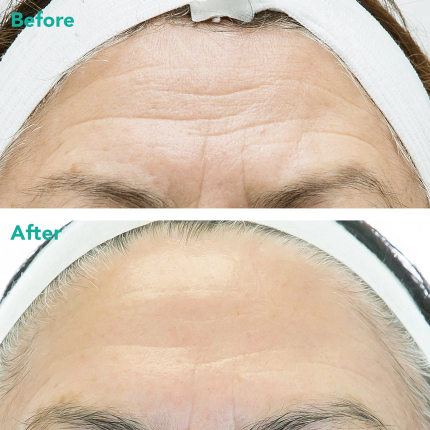 Advanced Anti-Aging Retinol + c-PDRN® Serum 30 mL / 1 fl oz